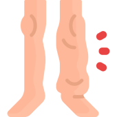 Linfedema